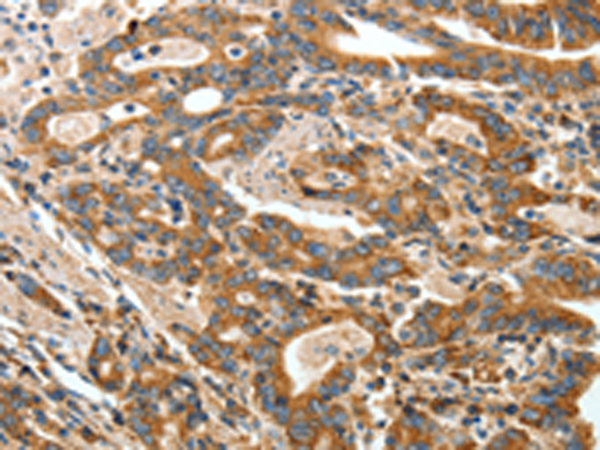 Rabbit Polyclonal Antibody to ANGPTL1