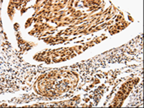 Rabbit Polyclonal Antibody to ANGPTL4