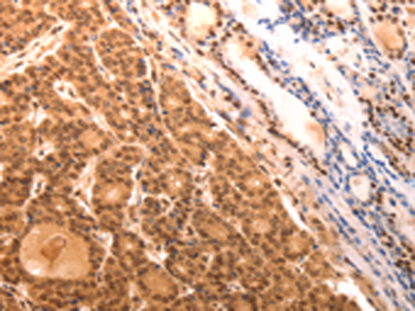 Rabbit Polyclonal Antibody to SERPINC1
