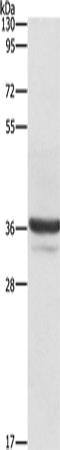 Rabbit Polyclonal Antibody to ANXA3