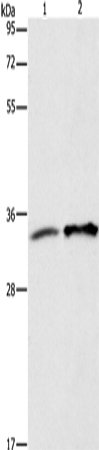 Rabbit Polyclonal Antibody to ANXA4