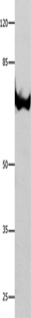Rabbit Polyclonal Antibody to ANXA6