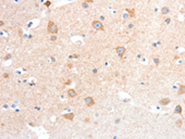 Rabbit Polyclonal Antibody to ANXA8