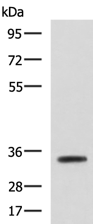 Rabbit Polyclonal Antibody to ANXA13