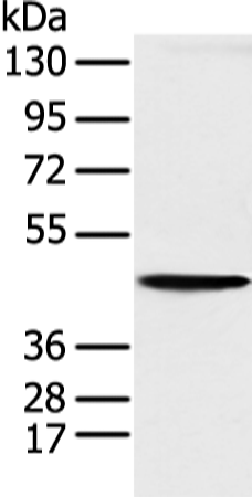 Rabbit Polyclonal Antibody to KRT18