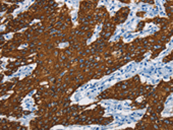 Rabbit Polyclonal Antibody to KRT8