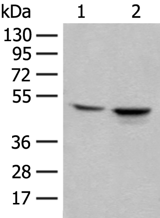 Rabbit Polyclonal Antibody to KRT17