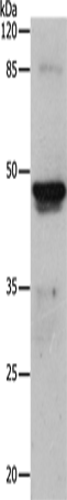Rabbit Polyclonal Antibody to KRT15