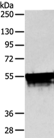 Rabbit Polyclonal Antibody to KRT4