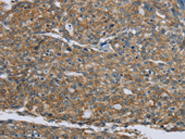 Rabbit Polyclonal Antibody to KRT5