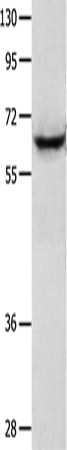 Rabbit Polyclonal Antibody to KRT2