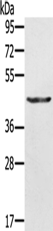 Rabbit Polyclonal Antibody to KRT31