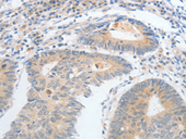 Rabbit Polyclonal Antibody to CALCR