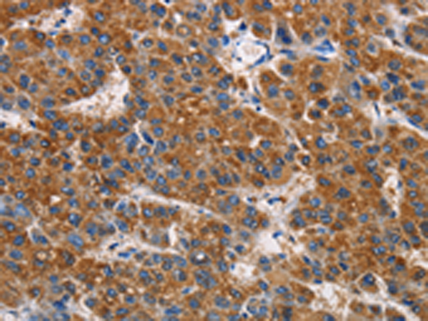 Rabbit Polyclonal Antibody to APLNR