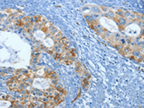 Rabbit Polyclonal Antibody to FSCN1