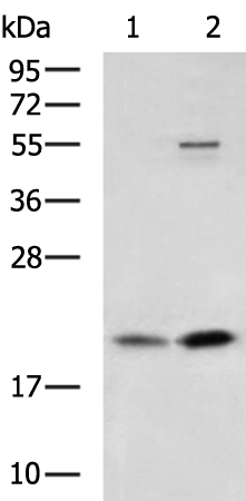 Rabbit Polyclonal Antibody to FTL