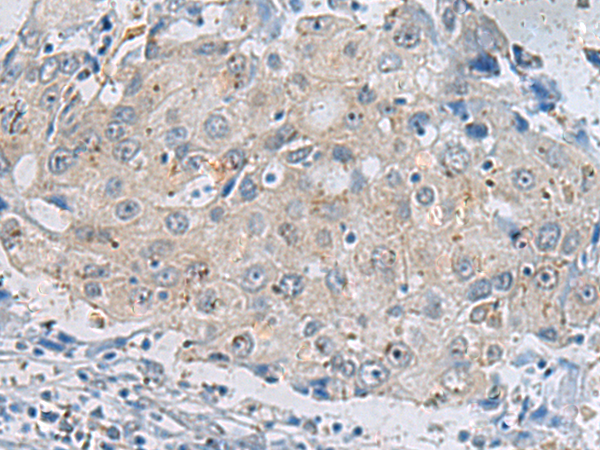 Rabbit Polyclonal Antibody to FTH1