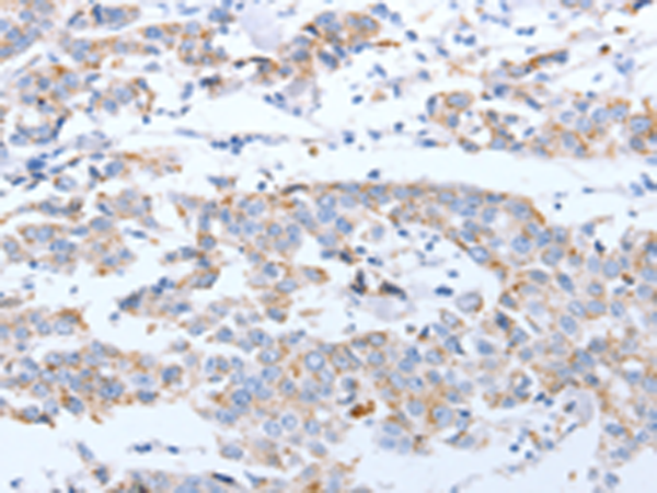 Rabbit Polyclonal Antibody to ARF4