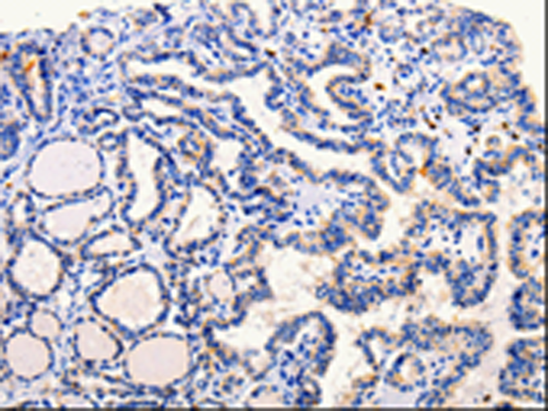 Rabbit Polyclonal Antibody to ARL6
