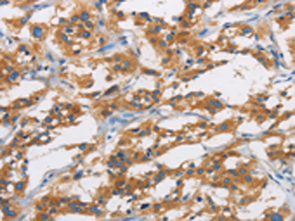 Rabbit Polyclonal Antibody to SAR1B