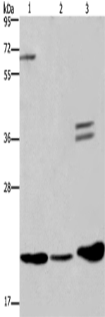 Rabbit Polyclonal Antibody to RAP1B