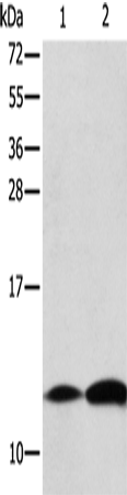 Rabbit Polyclonal Antibody to B2M
