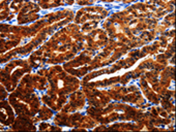Rabbit Polyclonal Antibody to TTR