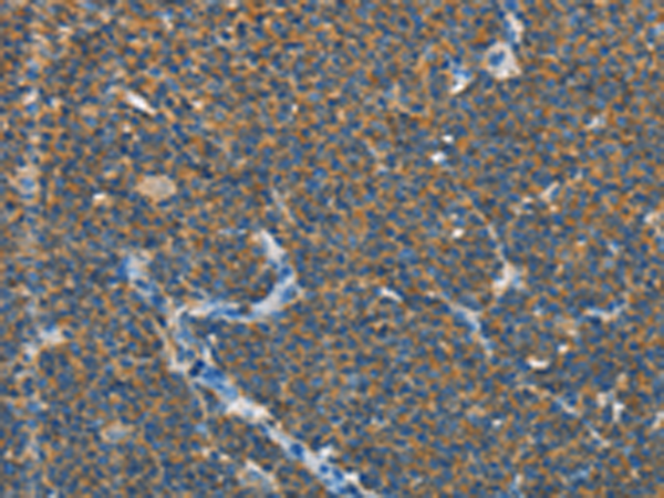 Rabbit Polyclonal Antibody to SEPTIN9