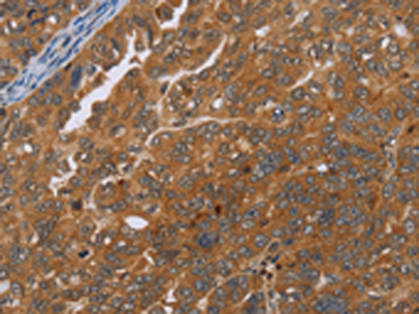 Rabbit Polyclonal Antibody to ADAMTS15