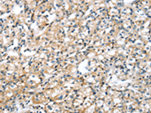 Rabbit Polyclonal Antibody to ACVR2B