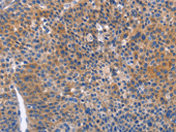 Rabbit Polyclonal Antibody to ARRB1