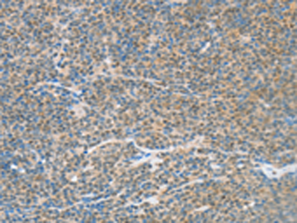Rabbit Polyclonal Antibody to ATF2