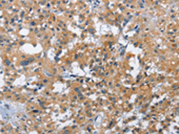 Rabbit Polyclonal Antibody to ATF4