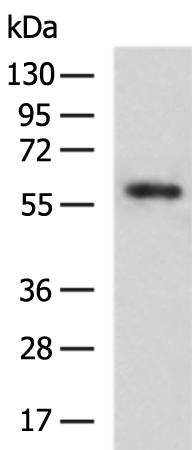 Rabbit Polyclonal Antibody to BACE1