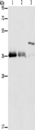 Rabbit Polyclonal Antibody to TNFSF13B