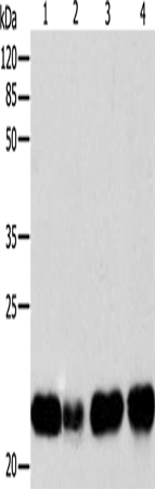 Rabbit Polyclonal Antibody to BID
