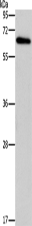 Rabbit Polyclonal Antibody to BIN1