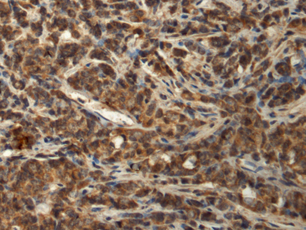 Rabbit Polyclonal Antibody to BIRC5