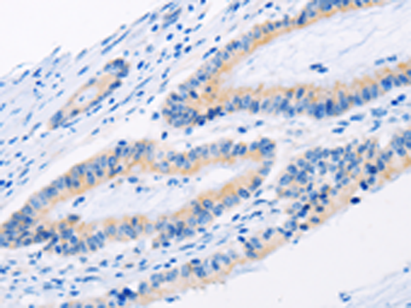 Rabbit Polyclonal Antibody to BMP3