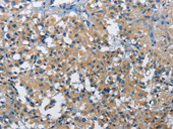 Rabbit Polyclonal Antibody to BMPR1B