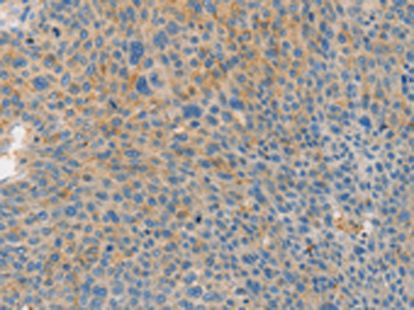 Rabbit Polyclonal Antibody to BRCA1