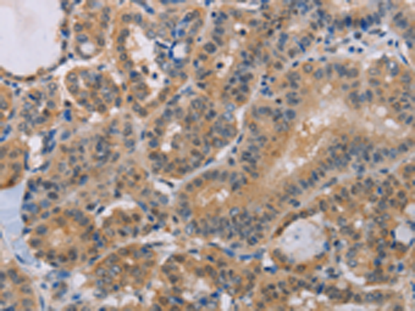 Rabbit Polyclonal Antibody to BTG1