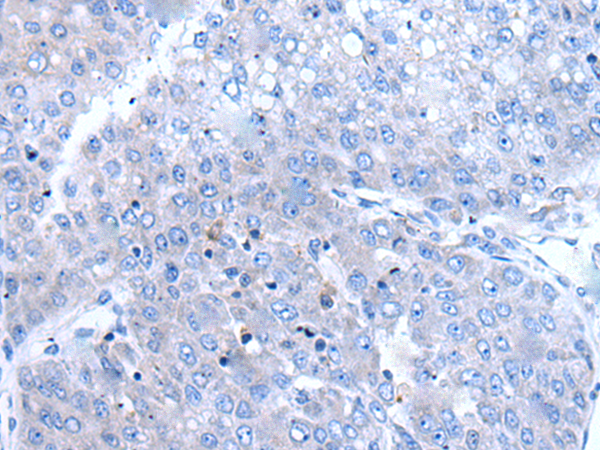 Rabbit Polyclonal Antibody to BTG4