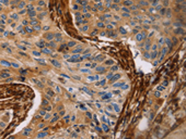 Rabbit Polyclonal Antibody to CALD1