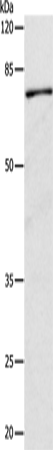 Rabbit Polyclonal Antibody to CAPN1