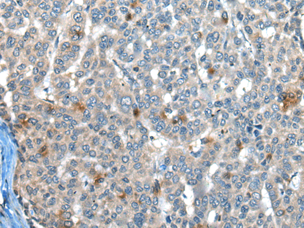 Rabbit Polyclonal Antibody to CAPN3