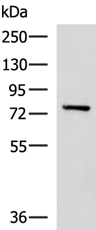 Rabbit Polyclonal Antibody to CAPN5