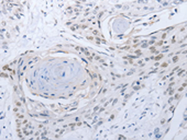 Rabbit Polyclonal Antibody to CAMK2B