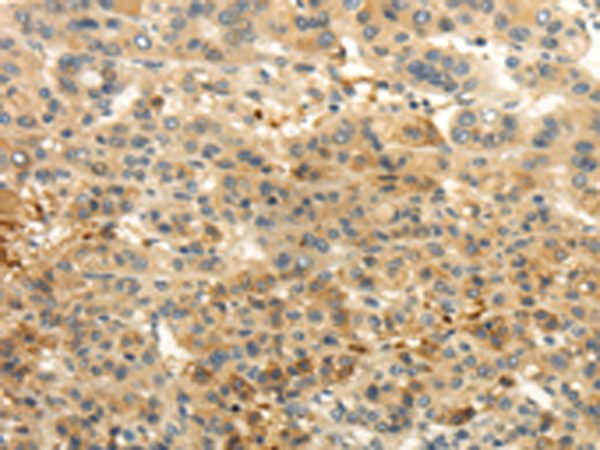 Rabbit Polyclonal Antibody to CAMK1G