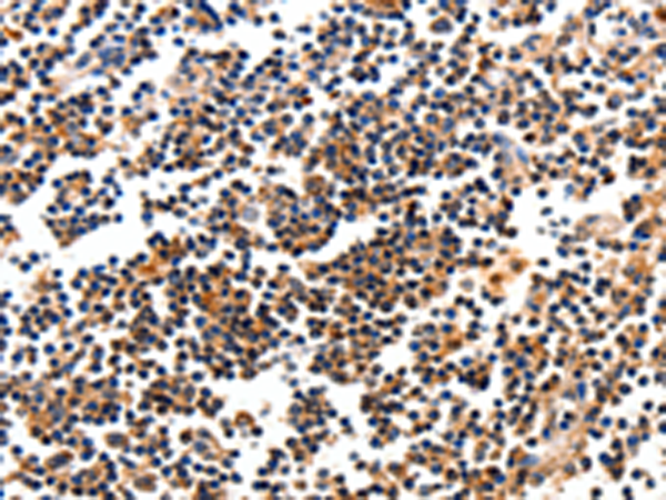 Rabbit Polyclonal Antibody to CAMK1